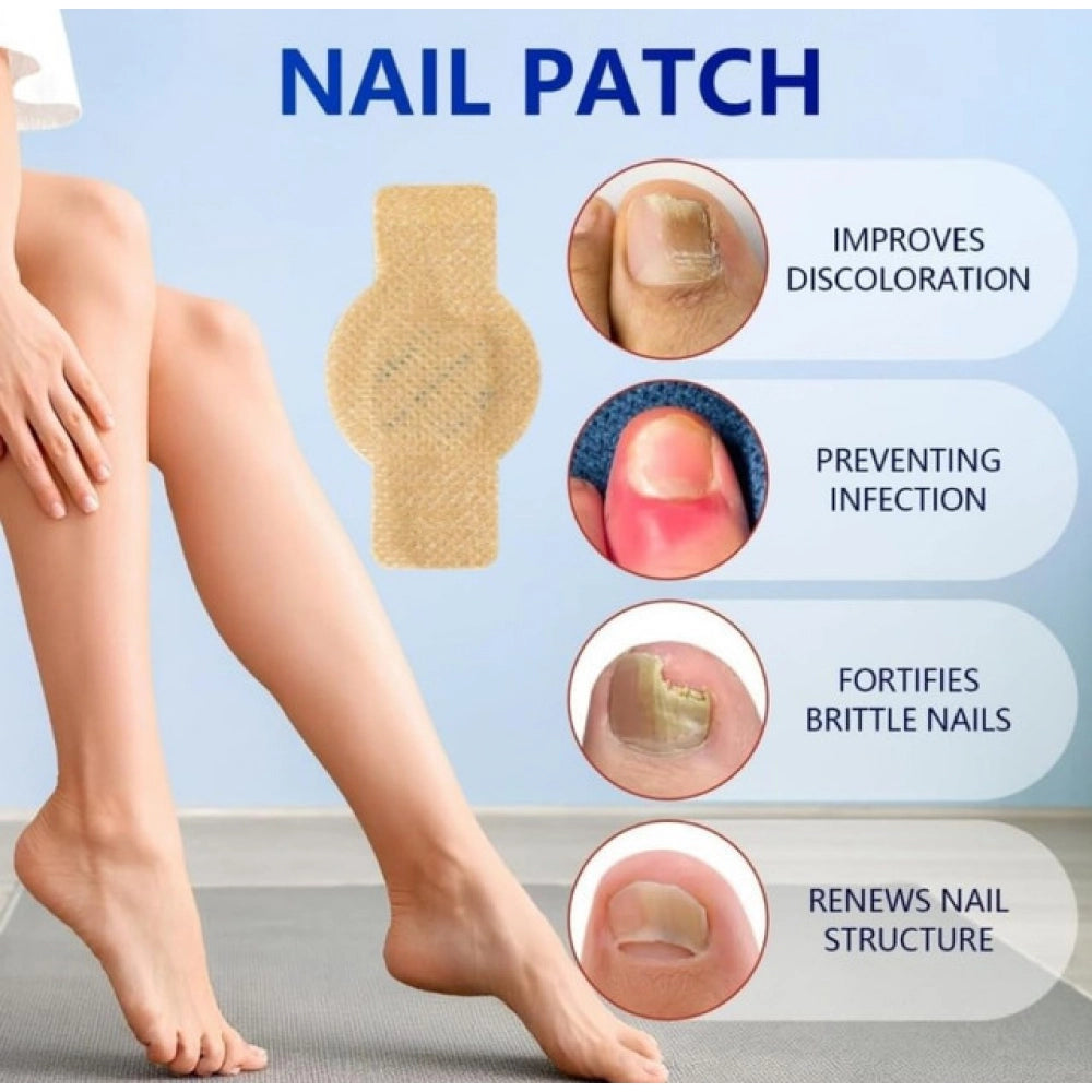 Fungal Nail Patches — Yellow